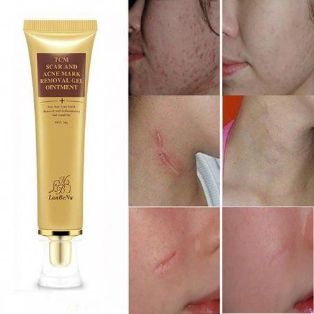 Creme removedor de cicatrizes e manchas