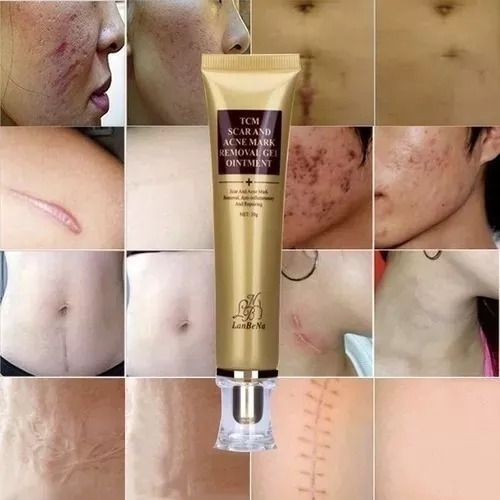 Creme removedor de cicatrizes e manchas